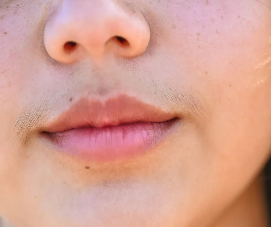 Wąsik/ broda/ zarost na twarzy u kobiet- jakie są  najlepsze metody aby się pozbyć? />